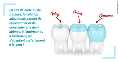 https://dr-elie-kikano.chirurgiens-dentistes.fr/L'INLAY ou l'ONLAY