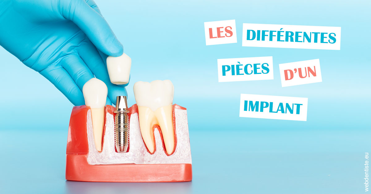 https://dr-elie-kikano.chirurgiens-dentistes.fr/Les différentes pièces d’un implant 2