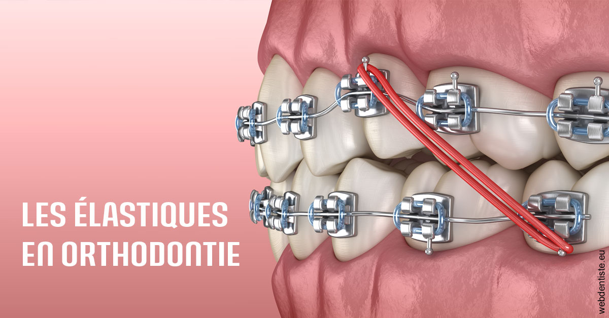 https://dr-elie-kikano.chirurgiens-dentistes.fr/Elastiques orthodontie 2