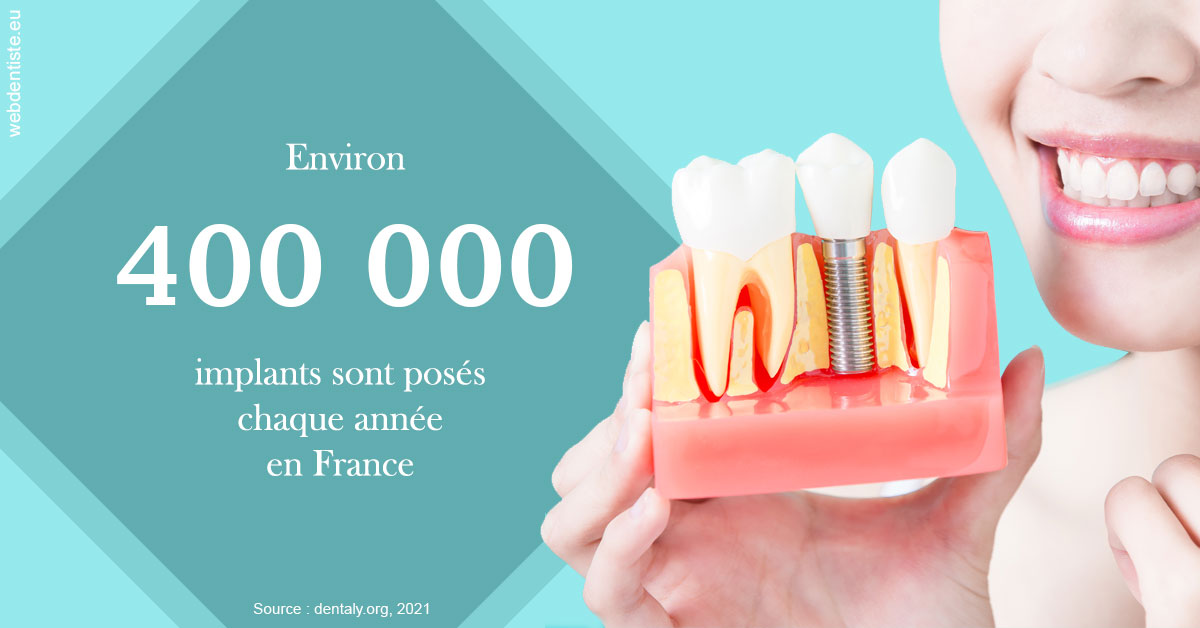 https://dr-elie-kikano.chirurgiens-dentistes.fr/Pose d'implants en France 2